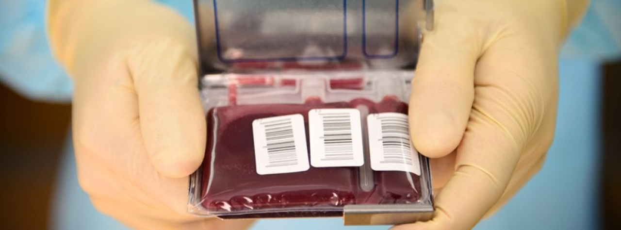 Стволовые клетки пуповинной крови: новые возможности современной медицины